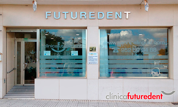 futuredent la cala de mijas