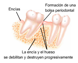 futuredent encias