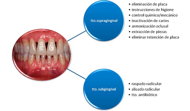 Evolución de la enfermedad