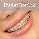 Ortodoncia Bracket Ceramica