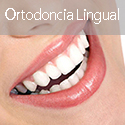 Ortodoncia Lingual