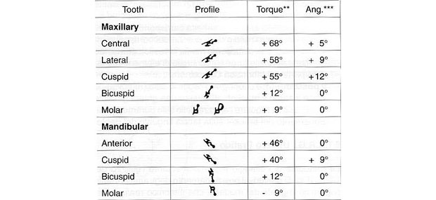 ortodoncia lingual braquet marcacion